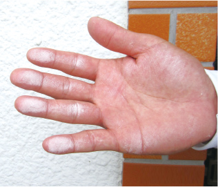 触ると手に粉がつく